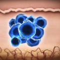 The Role of Exosomes in the Pathogenesis of CNS Diseases