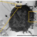 The Dark Side of Exosomes: Uncovering the Role of Senescent Cells in Disease Development