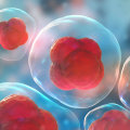 The Benefits and Costs of Stem Cell Therapy: An Expert's Perspective