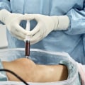 The Truth About Exosomes: What You Need to Know Before Seeking Treatment