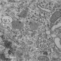 The Role of Exosomes in Central Nervous System Diseases