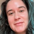 Is exosome skin booster safe?