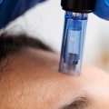 The Power of Exosomes: A Comprehensive Guide to Skin Regeneration