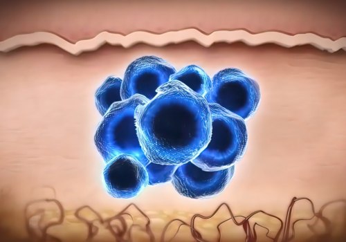 The Role of Exosomes in the Pathogenesis of CNS Diseases