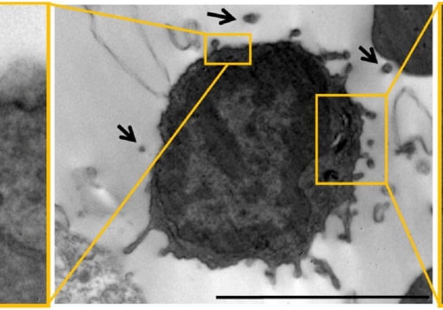 The Dark Side of Exosomes: Uncovering the Role of Senescent Cells in Disease Development