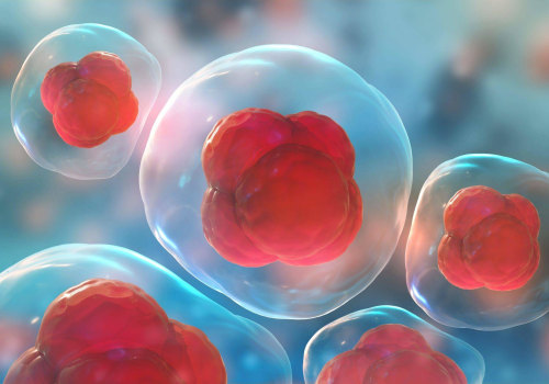 The Benefits and Costs of Stem Cell Therapy: An Expert's Perspective
