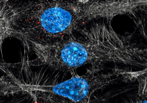 The Fascinating Role of Exosomes in Cancer Progression and Treatment