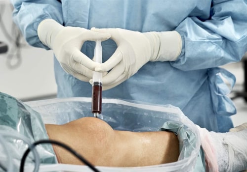 The Truth About Exosomes: What You Need to Know Before Seeking Treatment