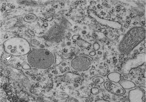 The Role of Exosomes in Central Nervous System Diseases