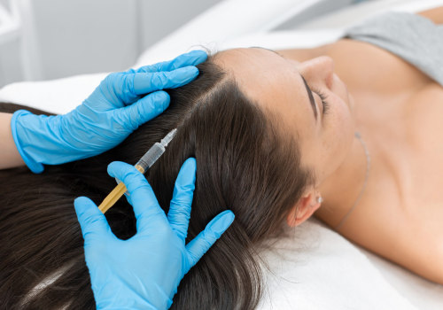 How to inject exosomes for hair loss?