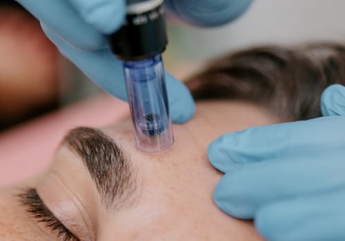 The Risks and Benefits of Exosome Therapy: An Expert's Perspective