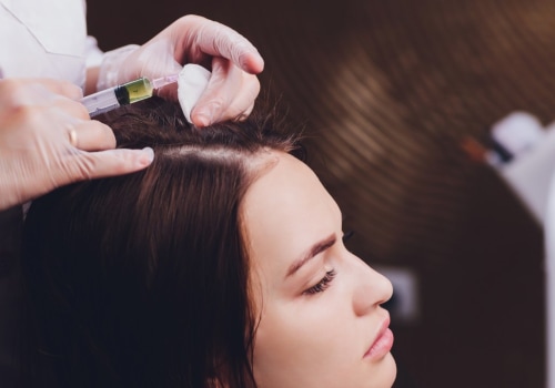 Is exosome hair therapy permanent?