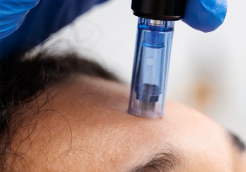 The Power of Exosomes: A Comprehensive Guide to Skin Regeneration